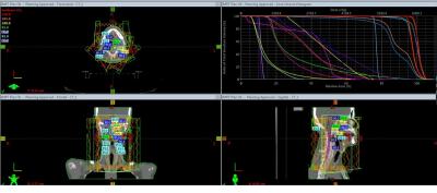 Perencanaan Penyinaran (Planning)