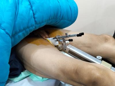 Brakhiterapi Pemasangan Aplikator